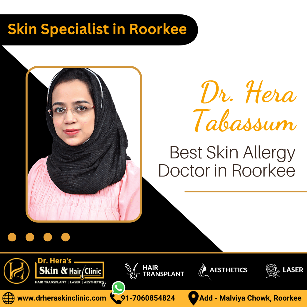 Skin Allergy Doctor in Roorkee
