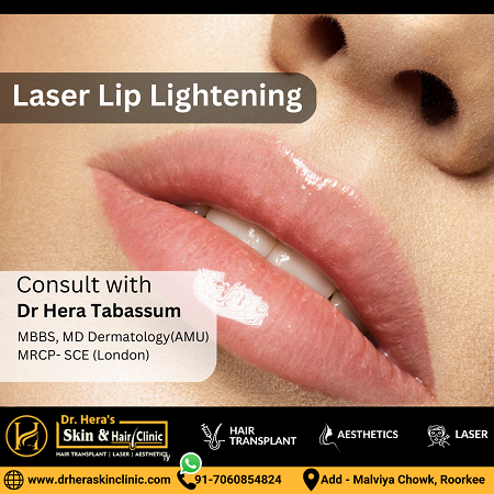 Laser Lip Lightening
