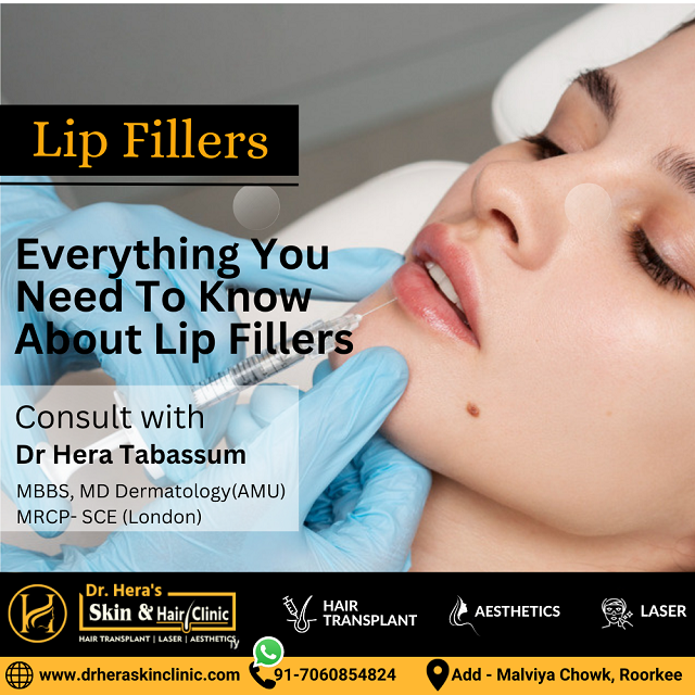 Lip Fillers in Roorkee