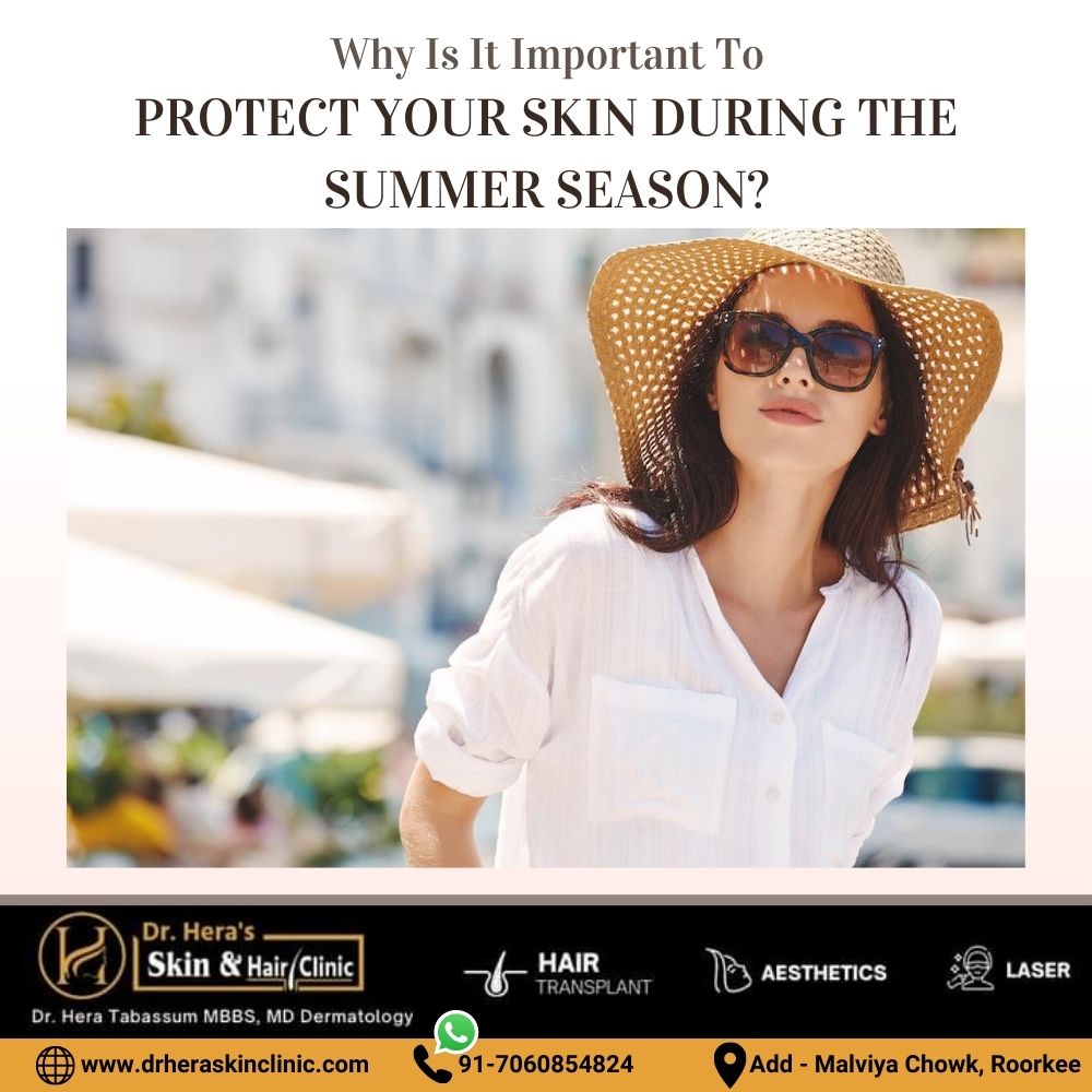 Protect Your Skin During The Summer Season