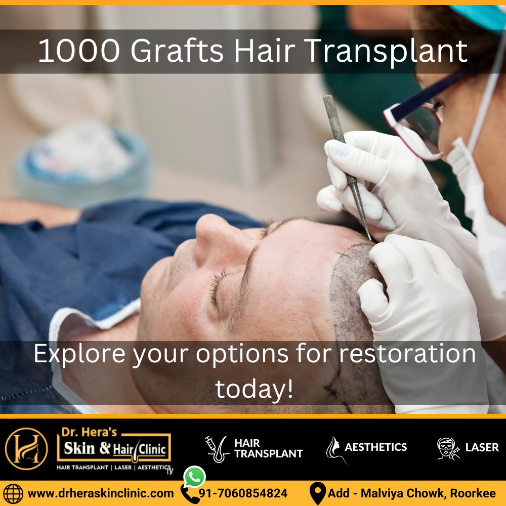 1000 Grafts Hair Transplant - Dermatologist in Roorkee