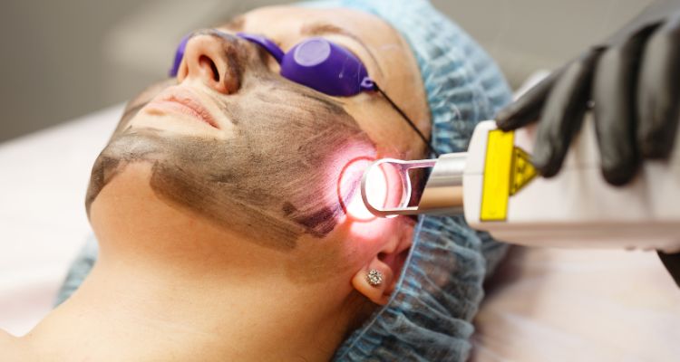 Laser Skin Resurfacing