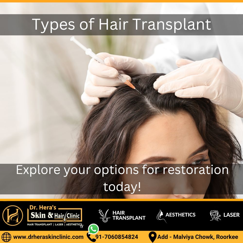 Types of Hair Transplant