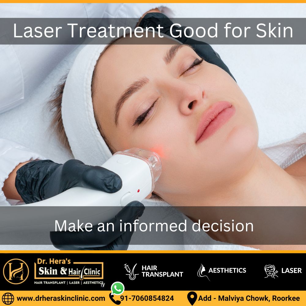 is laser treatment good for skin