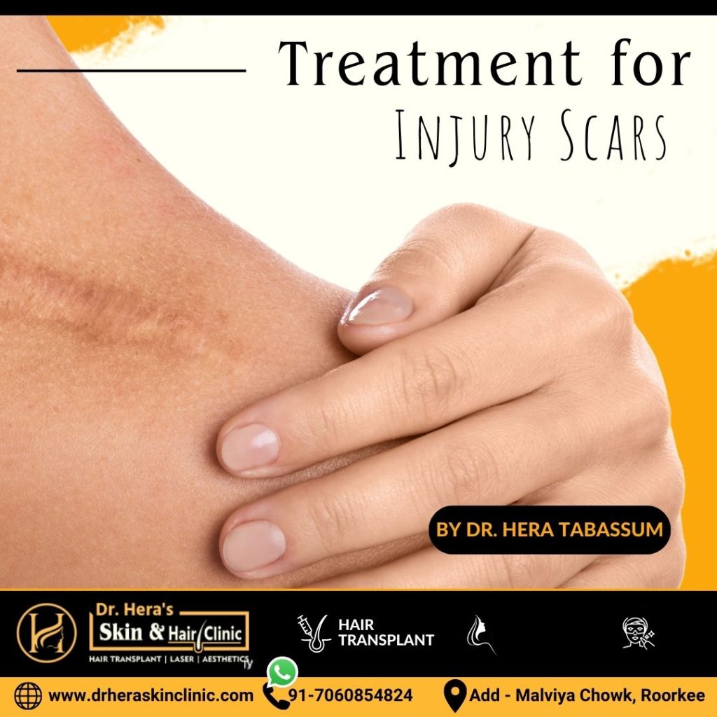 Treatment for Injury Scars