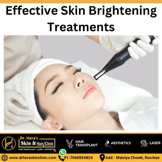 Skin brightening treatments