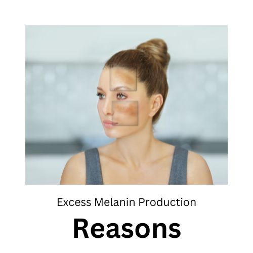 Causes of Excess Melanin Production