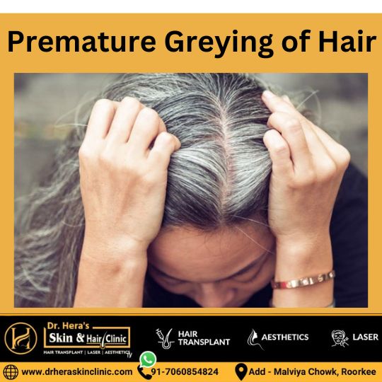 Premature Greying of Hair