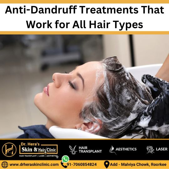 Anti dandruff treatment