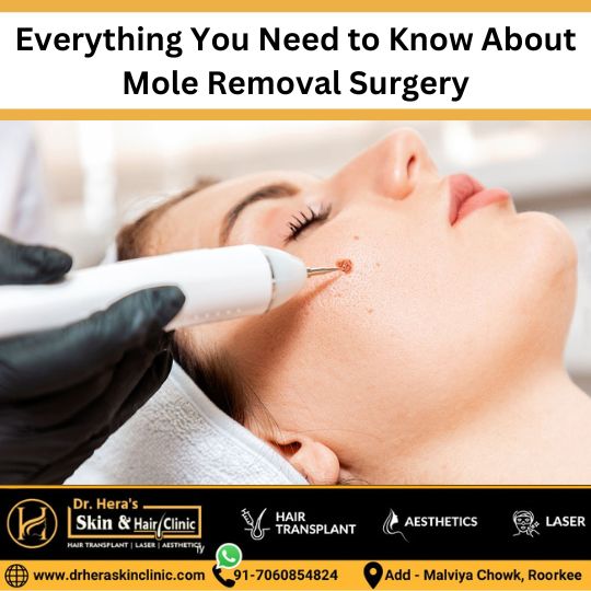 Mole removal surgery