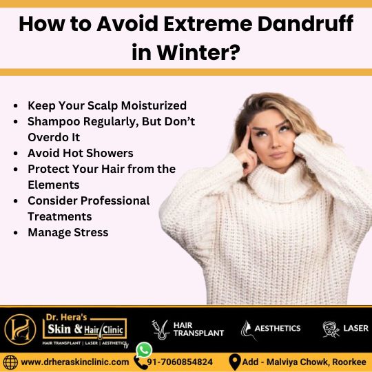 ways to avoid extreme dandruff in winters