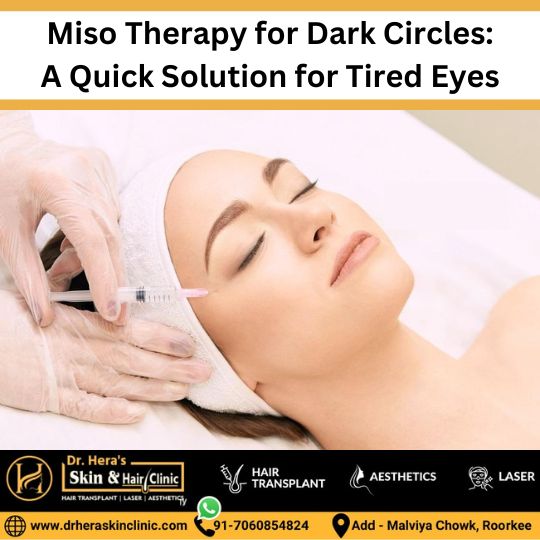 miso therapy for dark circles