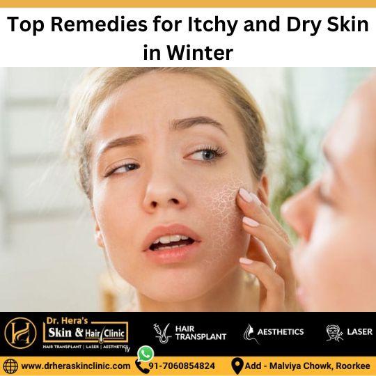 Solutions for itchy and dry skin