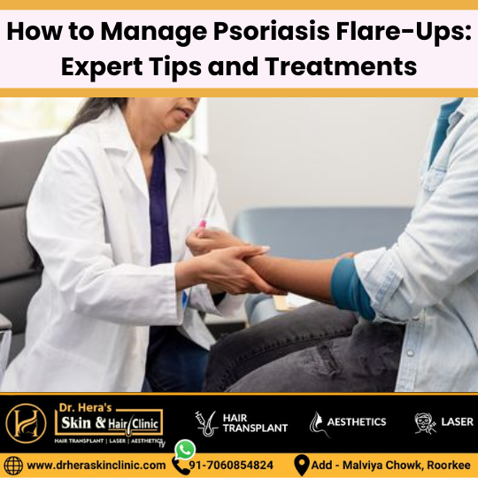 Managing psoriasis flare-ups