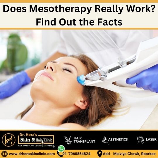 does mesotherapy really work