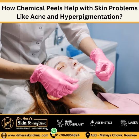 how chemical peels help with skin problems