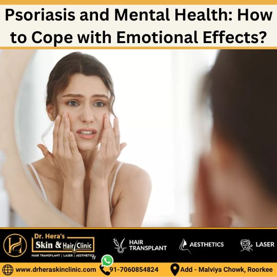 psoriasis and mental health