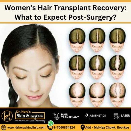 women hair transplant recovery