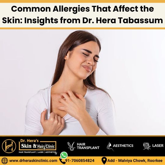 Common Allergies That Affect the Skin