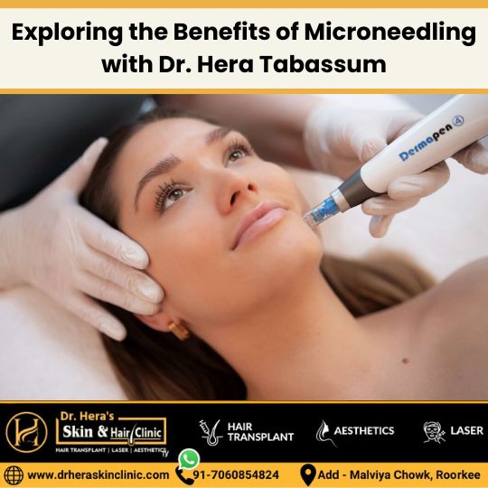 Exploring the Benefits of Microneedling with Dr. Hera Tabassum