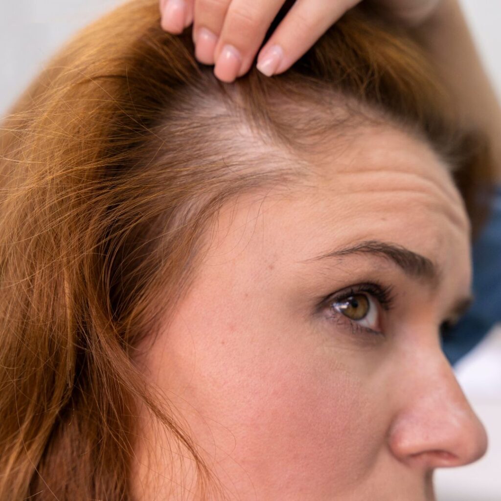 How to Regrow a Hairline: Proven Strategies for Healthier, Fuller Hair