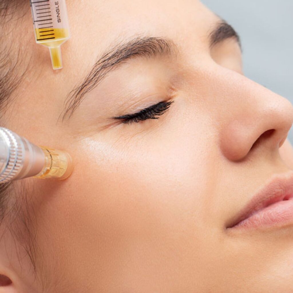 Skin Rejuvenation with Platelet-Rich Plasma (PRP): A Complete Guide