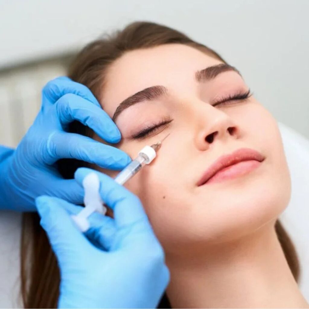 Under-Eye Filler: Is It Safe for Treating Dark Circles?