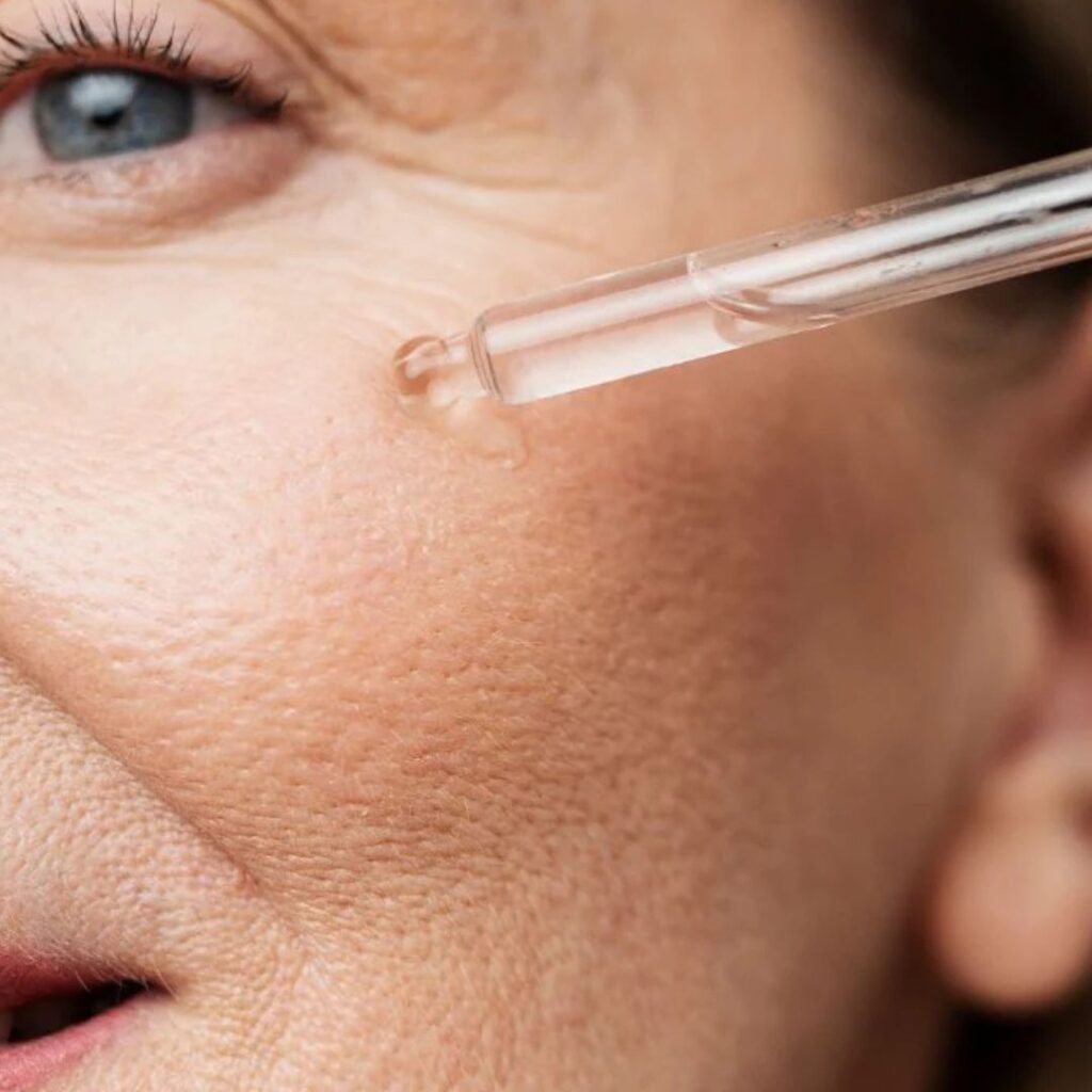 Can Vitamin C Remove Pigmentation on the Face