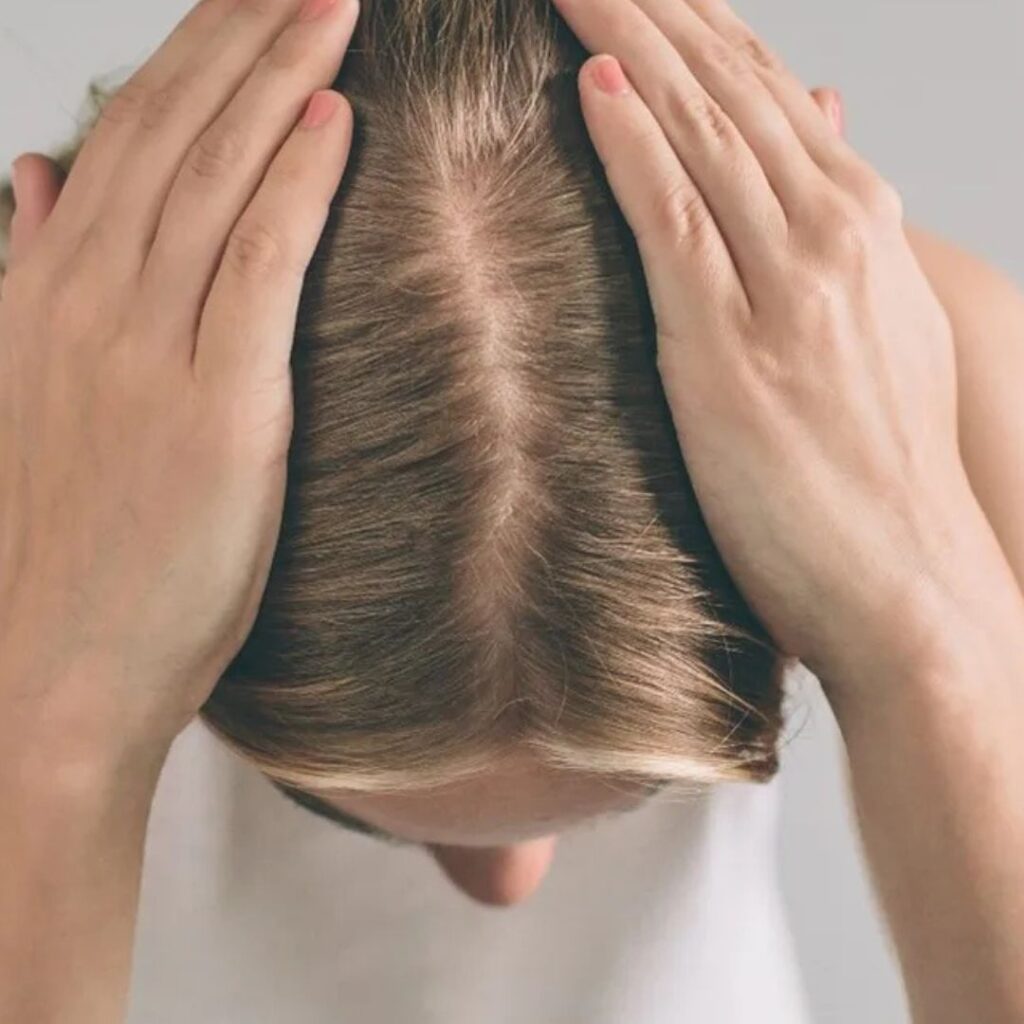 Scalp Folliculitis vs. Scalp Acne: Difference & Targeted Treatments
