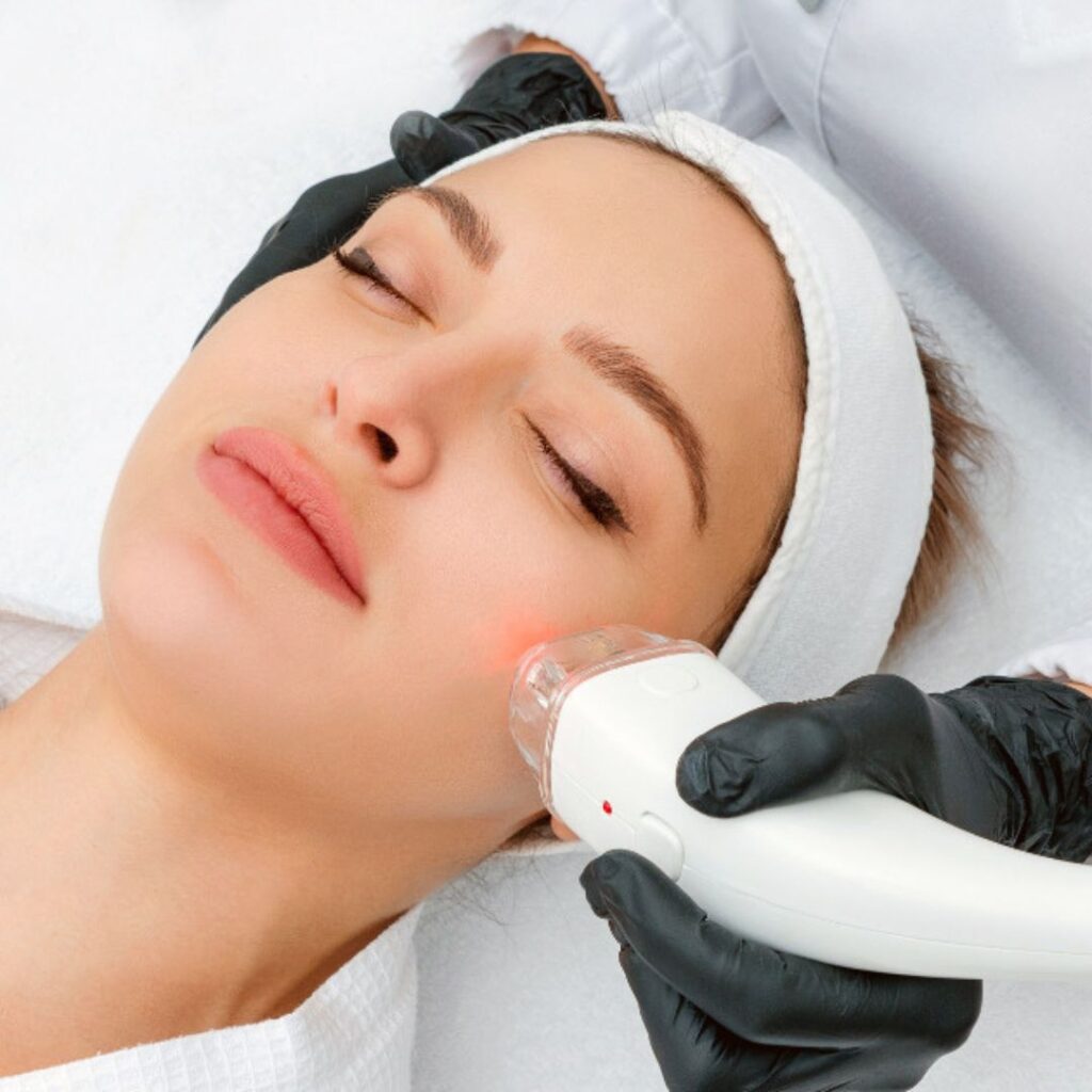 Is Laser Treatment for Skin Permanent?