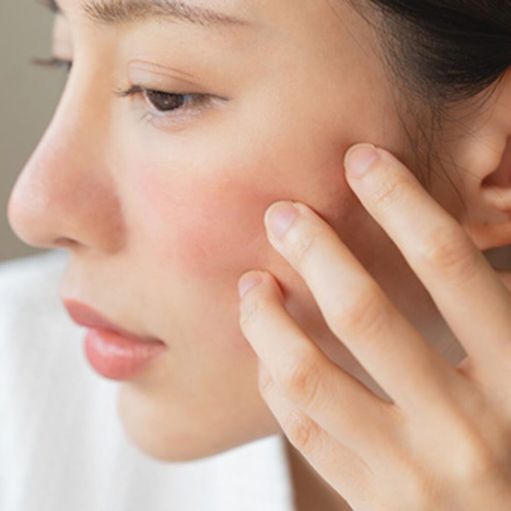 Why Your Skin Looks Dull in Winter & How to Restore Your Glow