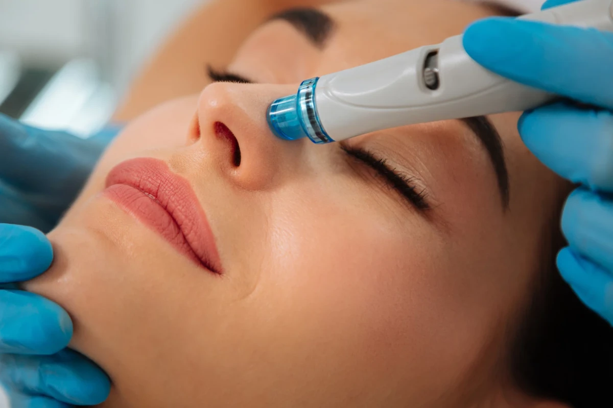 How Long Before the Wedding Should a Bride Get a HydraFacial?