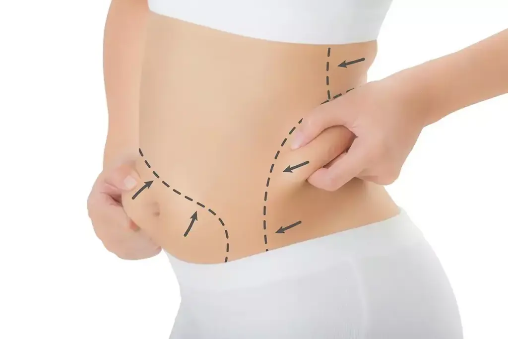 How Non-Surgical Body Contouring Helps Reduce Fat Where Diet and Exercise Fail?