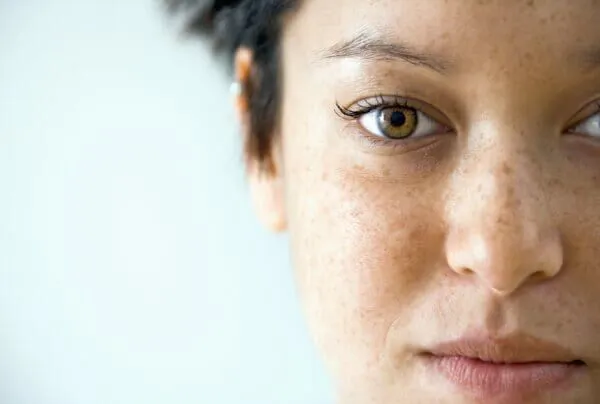 How to Identify Your Type of Pigmentation and Treat It Effectively