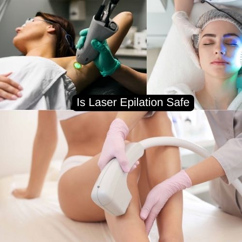 Is Laser Epilation Safe
