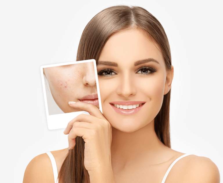 dermatologist in Roorkee