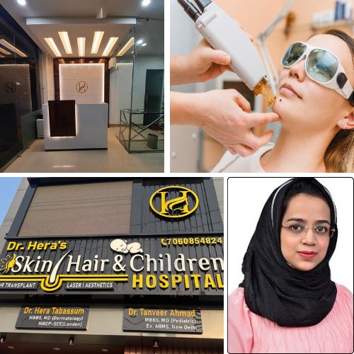 Can a mole regrow after laser removal?