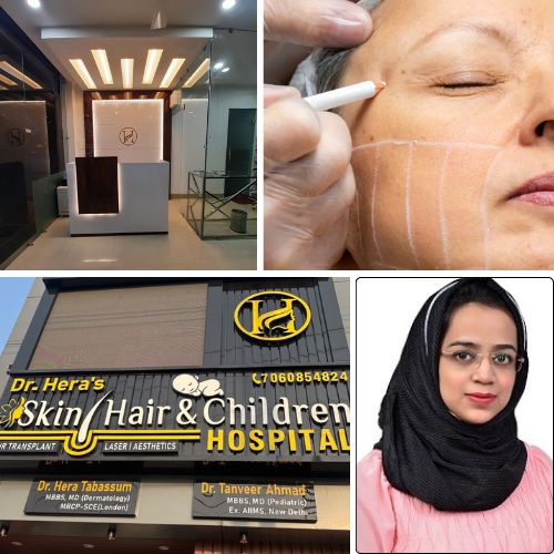 Does HIFU skin tightening really work?