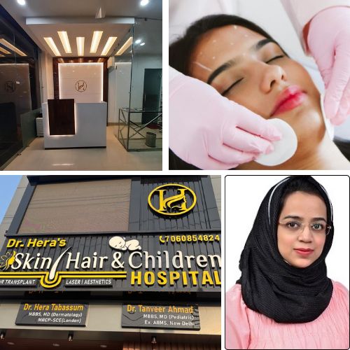 What Is the Best Skin Treatment Before an Event