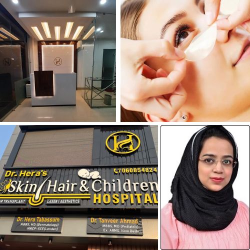 What Is the Best Treatment for Under Eyes?