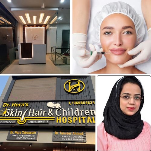 What not to do after lip fillers