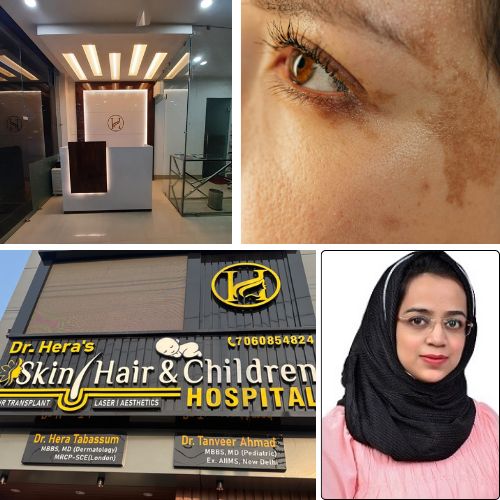 When to be concerned about skin pigmentation?