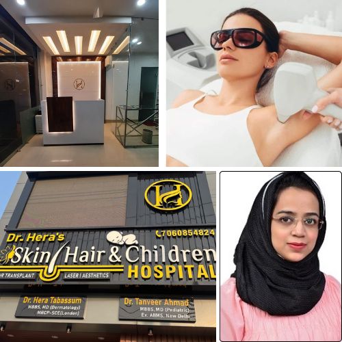 Which Laser Is Best for Laser Hair Reduction?