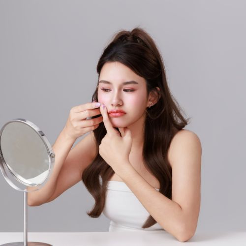 Acne Treatment for Teen Girls