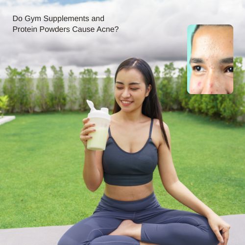 Do protein powders cause acne