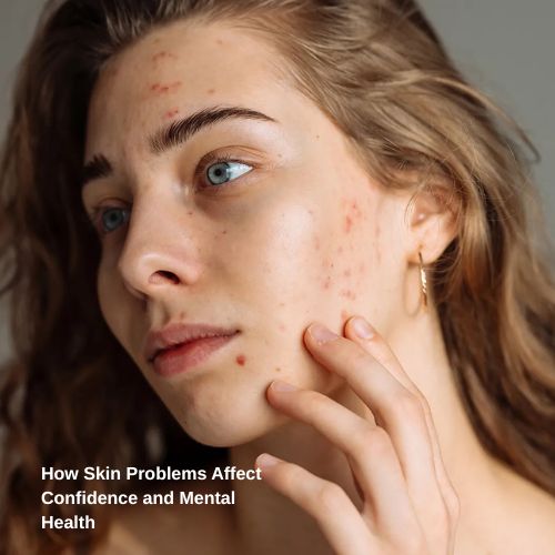 How Skin Problems Affect Confidence and Mental Health