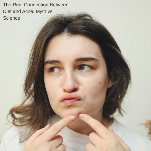 diet and acne relationship