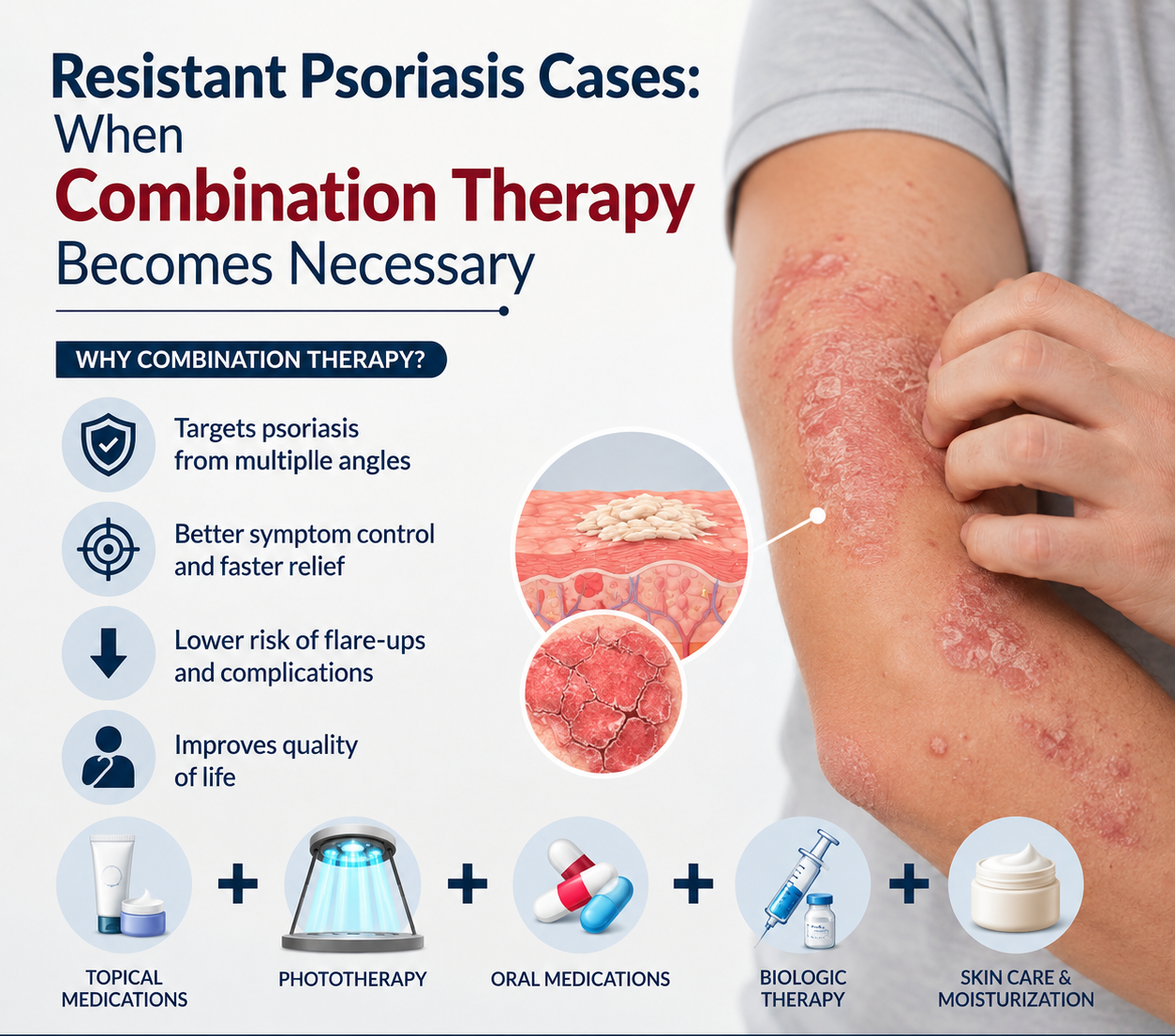 Combination Therapy for Psoriasis