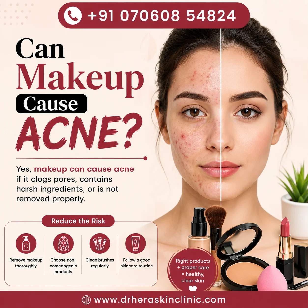 Can Makeup Cause Acne? Illustration showing acne-prone and clear skin with makeup products, expert skincare guidance from Dr. Hera Skin Clinic, Roorkee.