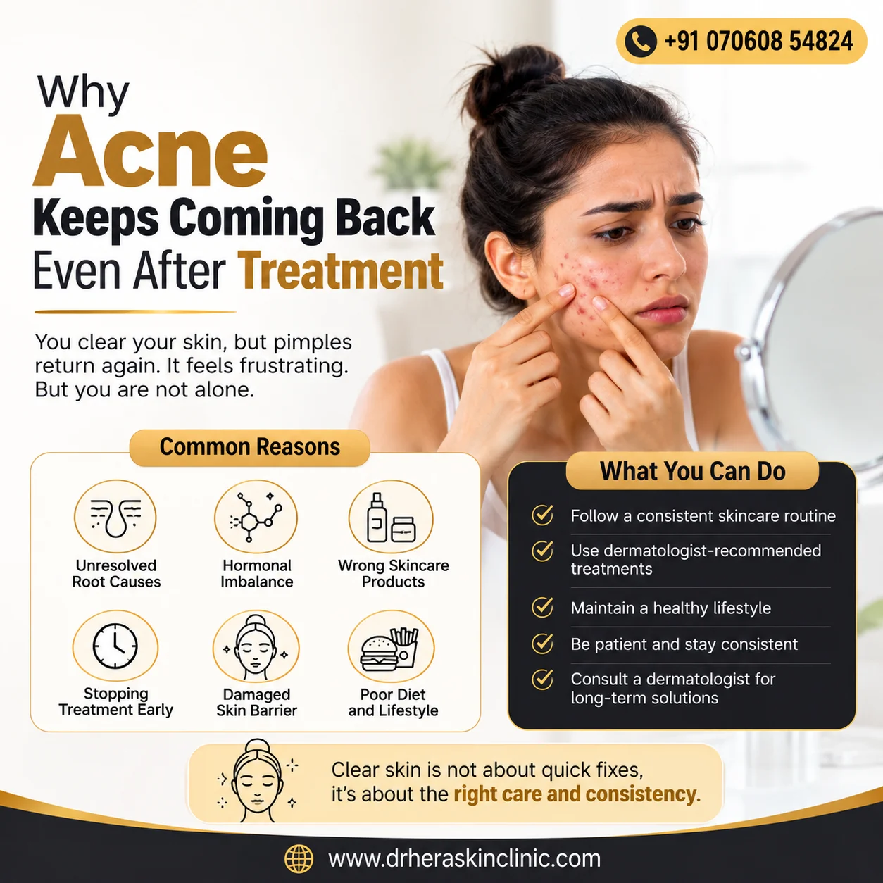 Why Acne Keeps Coming Back Even After Treatment